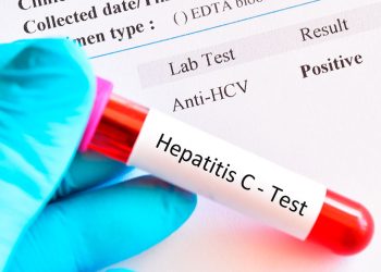 Test d'hepatitis / Calderón